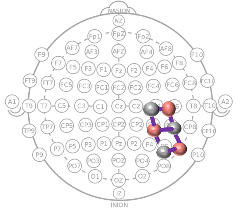Channel and ROI analysis illustration