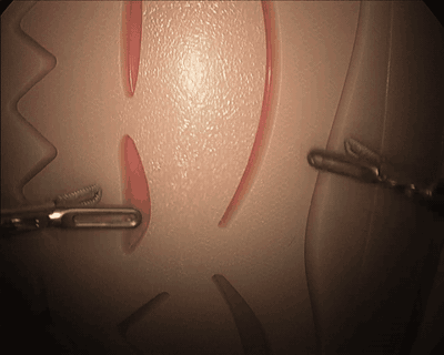 Visualization of the surgical skill transfer process across platforms