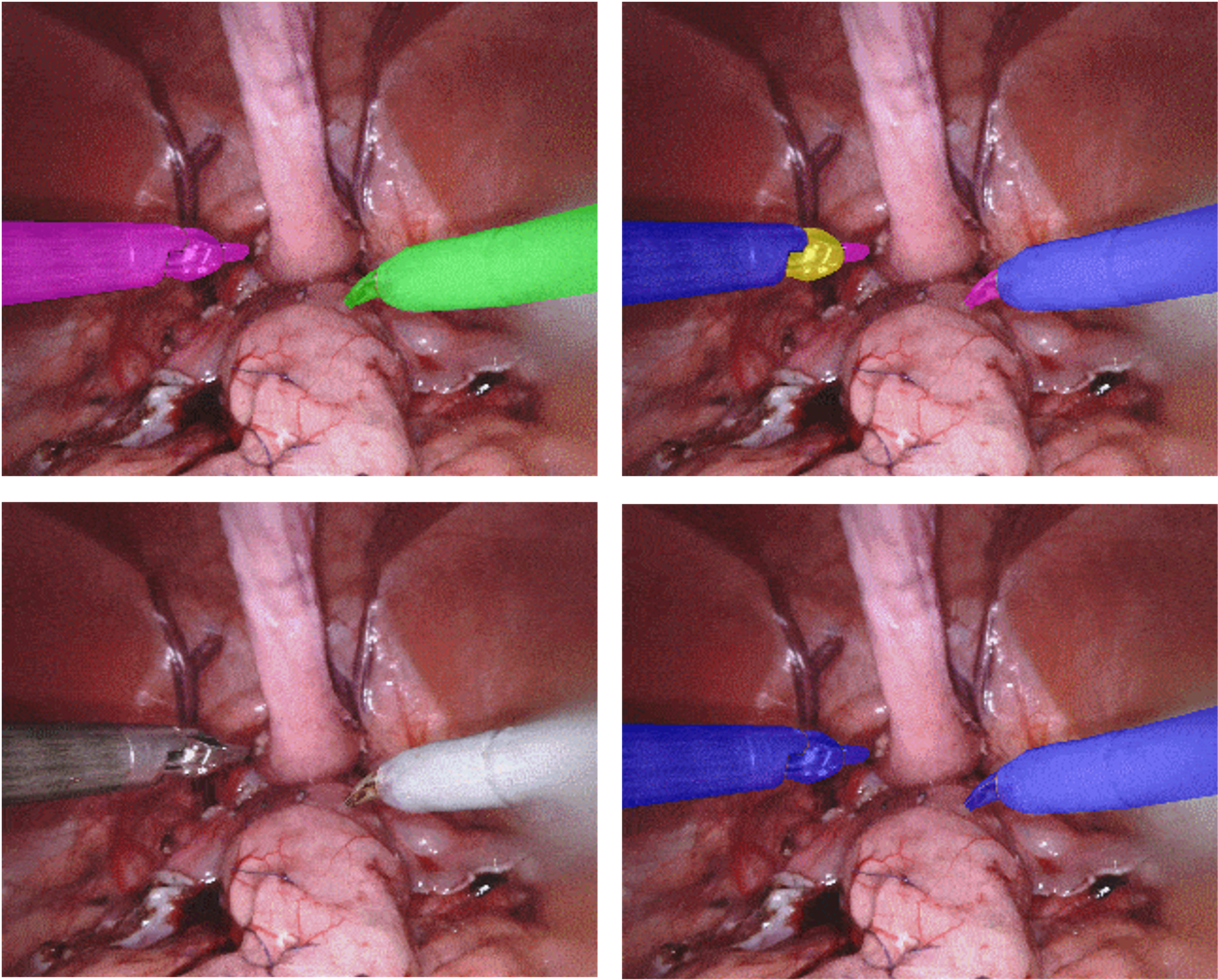 Surgical project image